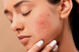 Sensitive Skin Solutions: Common Mistakes and How to Avoid Them